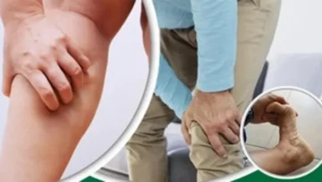 শীতে নিউমোনিয়া প্রতিরোধে যা যা খাবেন