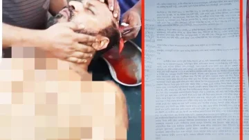 সোনাইমুড়ীতে জমি নিয়ে বিরোধ: দুই ভাইকে কুপিয়ে জখমের ঘটনায় মামলা